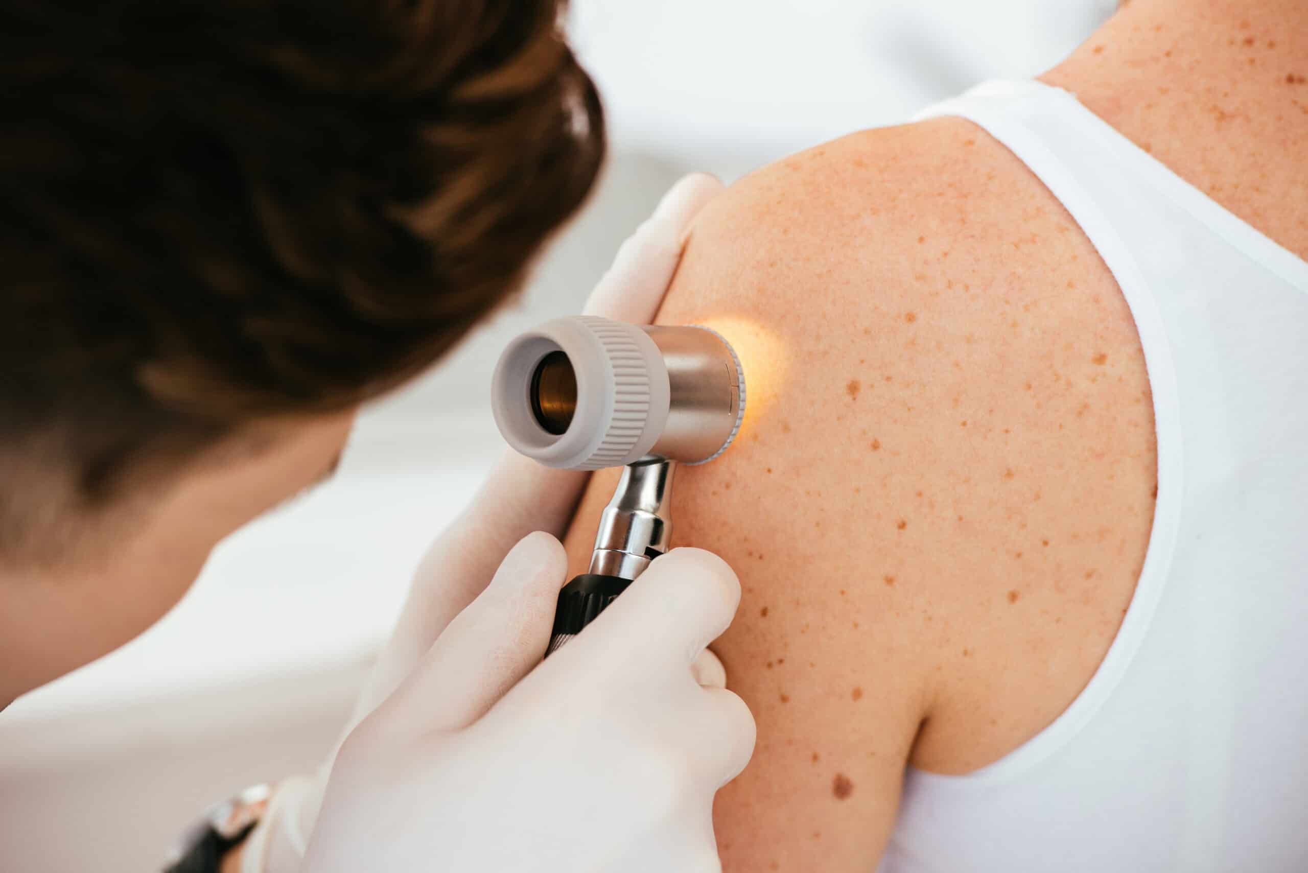 Hausarzt Praxis Söchtenau - Leistung - Dermatologie
