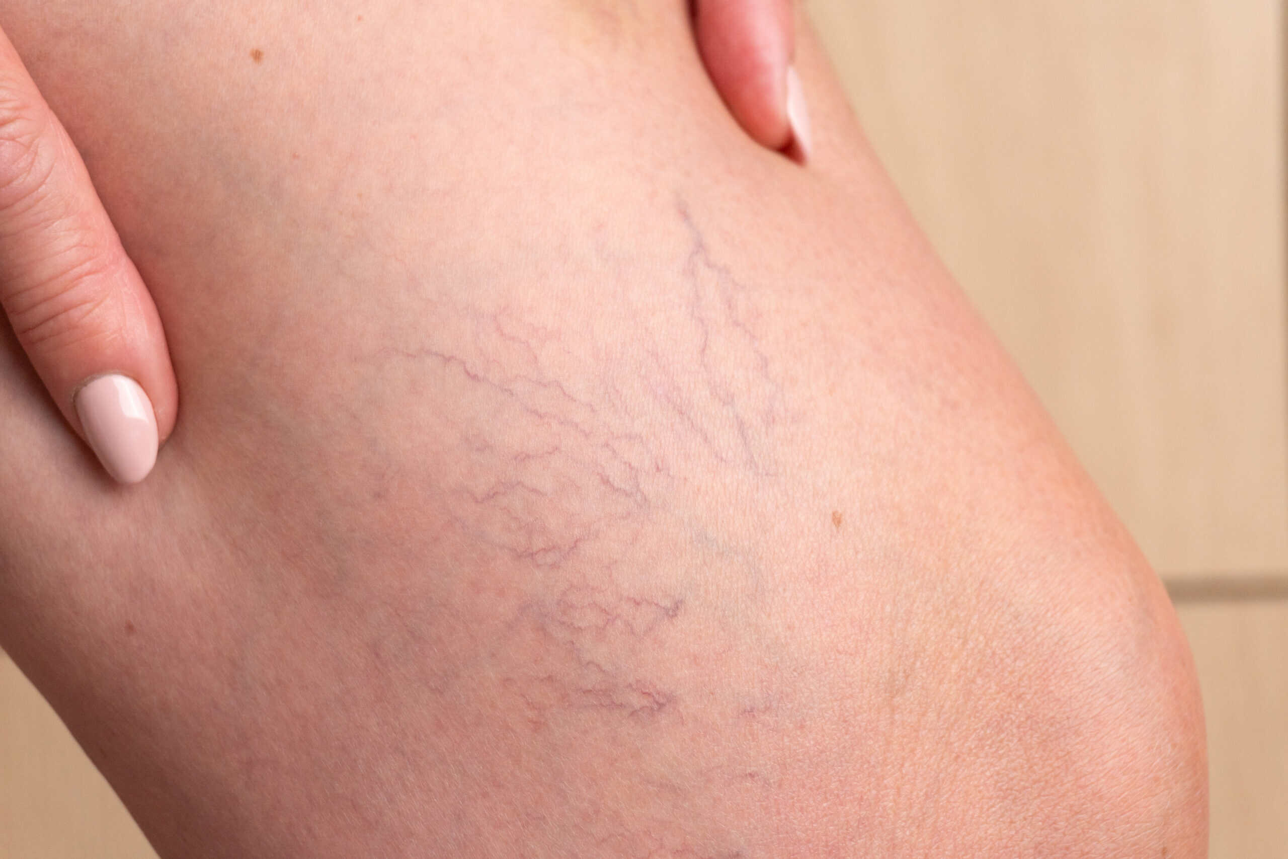 Hausarzt Praxis Söchtenau - Leistung - Dermatologie