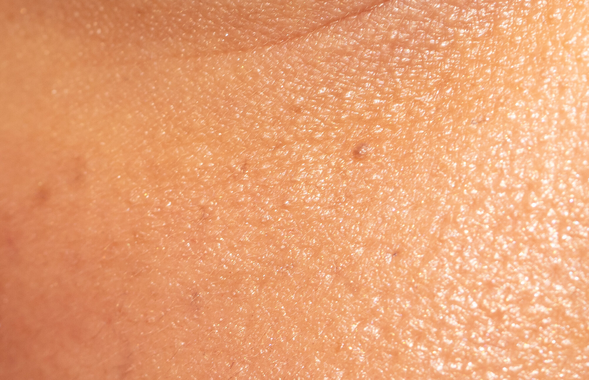 Haut – Dermatologie München Süd